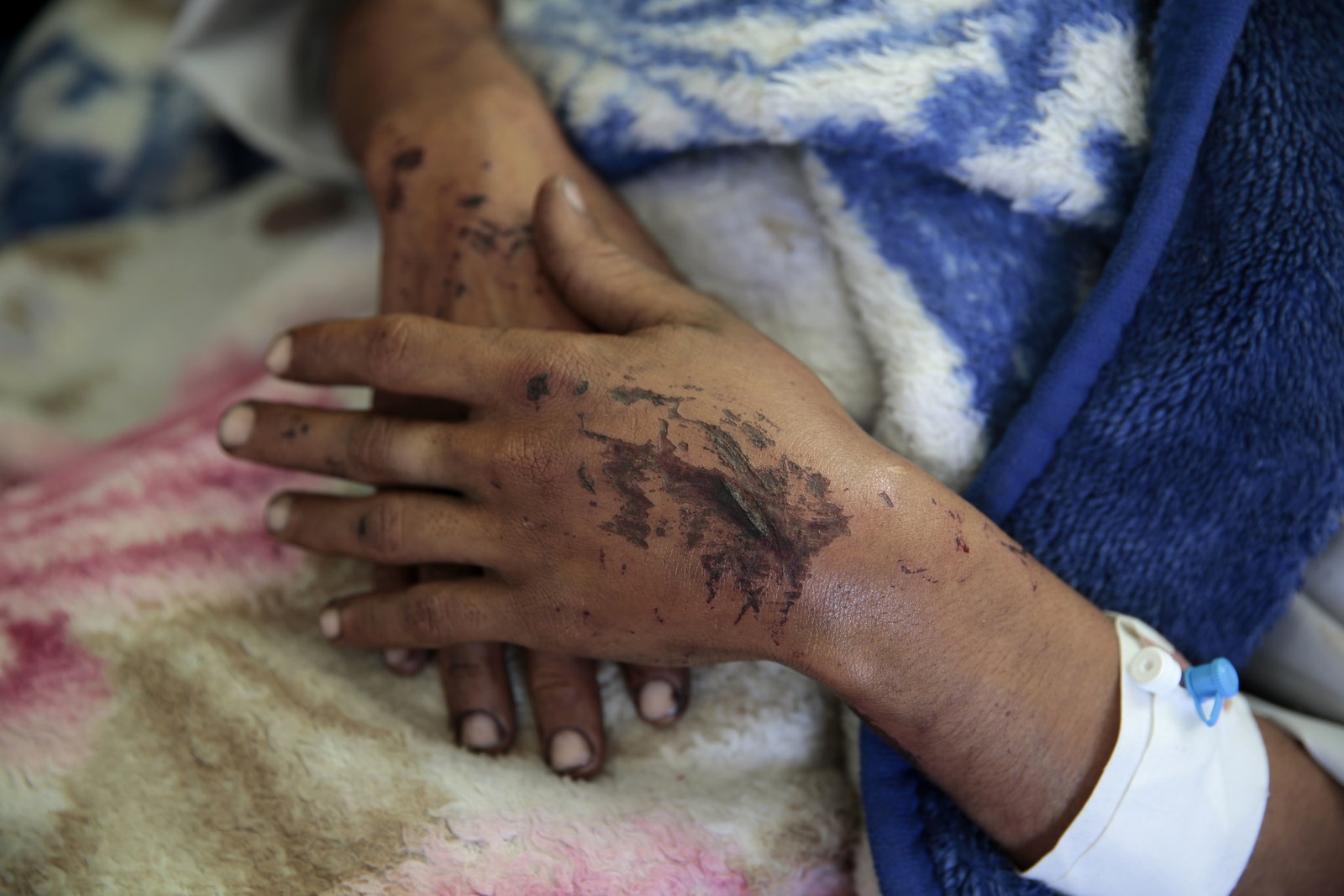 De dödade i Yemen är också Sveriges ansvar