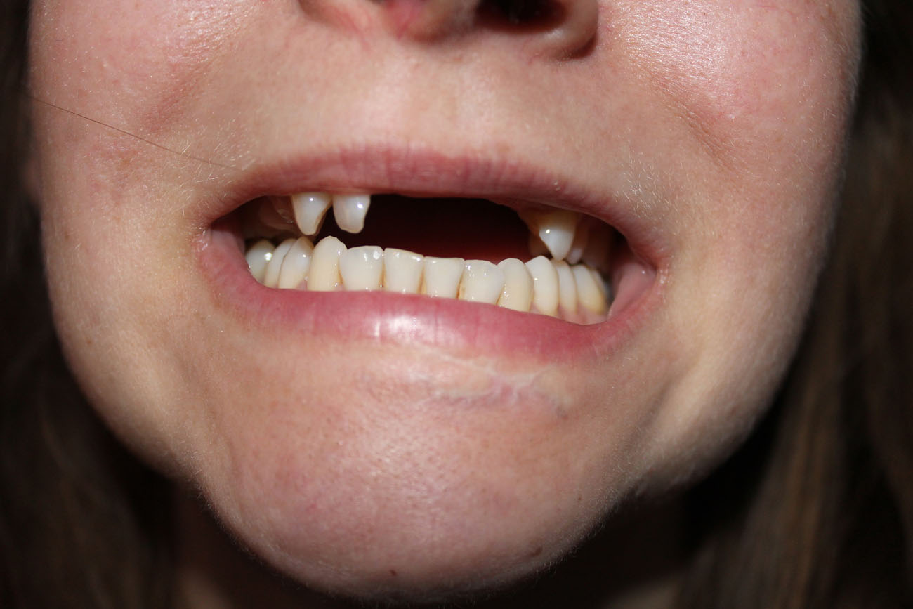Tändernas pris