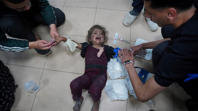 Ett barn som skadats i ett israeliskt flyganfall vårdas på al-Aqsa-sjukhuset i Gaza i lördags. Bild: Saher Alghorra/AP.